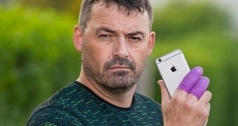 Exploding iphone 7 causes heavy bleeding owner says he could have lost his hand