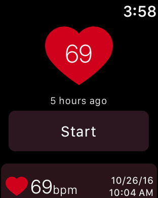 Cardiograph for iwatch