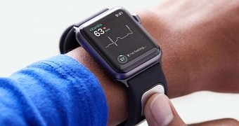 Apple watch could detect hyperkalemia with alivecor s kardiaband study finds